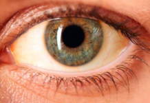 Puntos amarillos en los ojos: cuándo son efecto del sol y cuándo pueden alertar sobre una enfermedad del hígado
